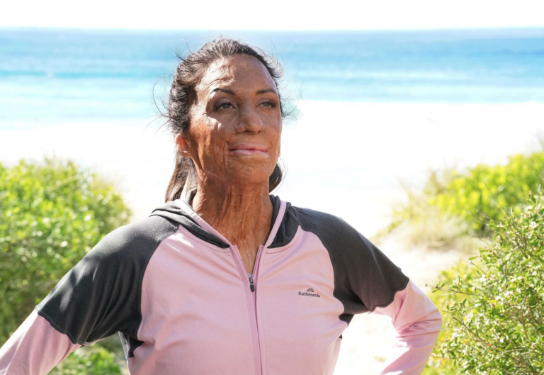 Turia Pitt named ambassador for Kathmandu Coast to Coast